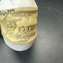 Full Mouth Teeth Mold Metal Jaw Dentures Impressions Oddity Macabre Halloween/#2